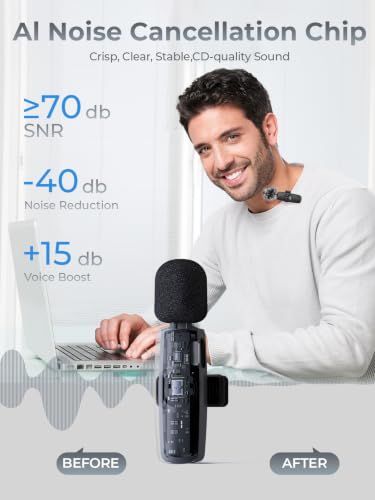 3-in-1 Wireless Lavalier Microphone: Mini Microphone 20H Battery, 80ft Range, DSP Noise Cancel - Plug & Play for iPhone Android, Live Streaming, Content Creators Programmes