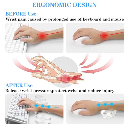 Acrylic Transparent Computer Keyboard Stand with Gel Cloud Keyboard and Mouse Wrist Rest, Ergonomic Tilting 3-in-1 Set, Relieves Painful Typing, for Office/Computer/Laptop/Gaming - color: Clear Cloud Set