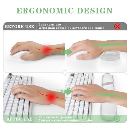 Keyboard and Mouse Wrist Rest, Silicone Gel Ergonomic Mouse Pad with Wrist Rest Set, Gaming Mousepad Arm Cushion Support for Computer Office Desk Accessories (Clear Gel White Set - 2) - color: Clear Gel White Set - 2