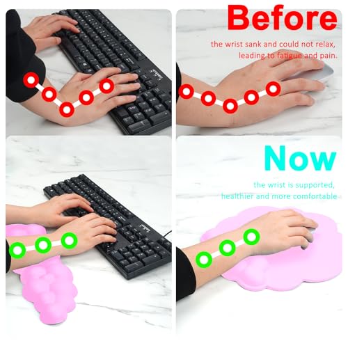 Cloud Keyboard and Mouse Wrist Rest Pad for Computer Arm Pain Relief- Ergonomic Wrist Support Mousepad with Non-Slip PU Base for Office, Gaming, and Home Use Anti-Fatigue(Pink) - color: Rose