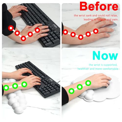 Cloud Keyboard and Mouse Wrist Rest Pad for Computer Arm Pain Relief- Ergonomic Wrist Support Mousepad with Non-Slip PU Base for Office, Gaming, and Home Use Anti-Fatigue(White) - color: White
